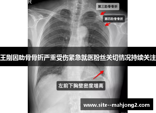 王刚因肋骨骨折严重受伤紧急就医粉丝关切情况持续关注 王刚因肋骨骨折严重受伤紧急就医粉丝关切情况持续关注